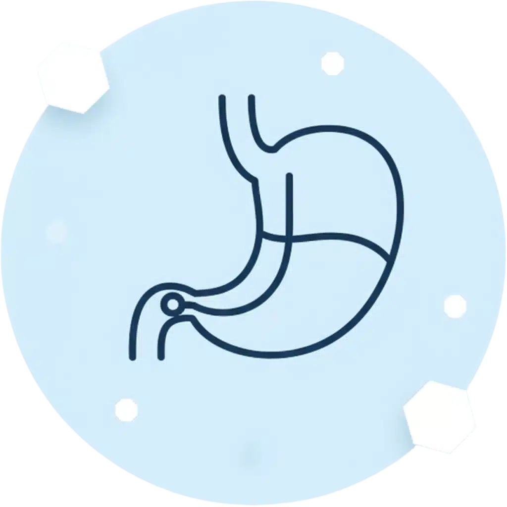 تكميم المعدة وتحويل المسار المصغر